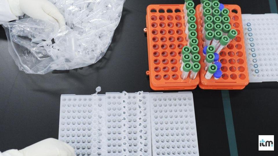 A novel FDA-authorized COVID-19 test doesn’t require a lab and can provide results in only 5 minutes 1 Different tests that examine blood for antibodies | LegalTechMunch